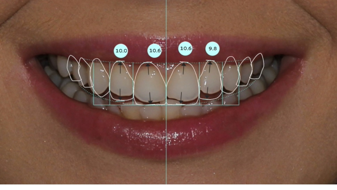 Digital Smile Design
