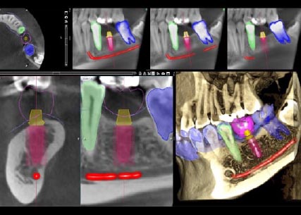 Цифровая восстановительная стоматология