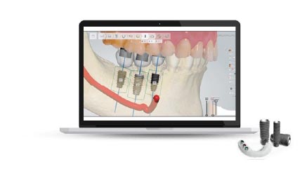 Advantages  of  Digital  Dentistry